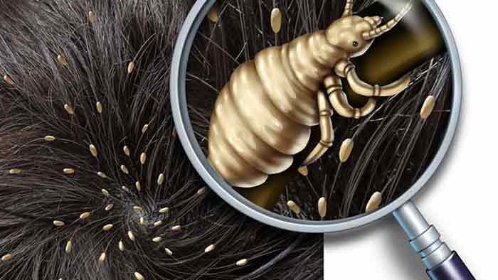 how to check yourself for lice, without comb eggs paranoid