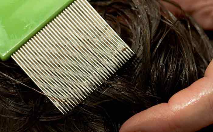 Check for lice yourself without a comb