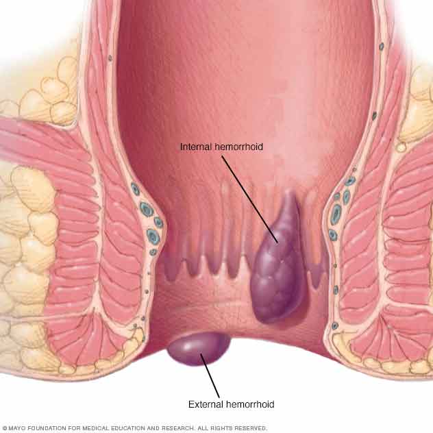 Hairy vulva 2010 jelsoft enterprises ltd