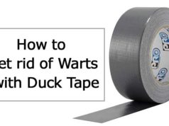 How to get Rid of Warts with Duct Tape How to use duct tape for warts