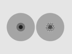 Bumps on & around Nipple-White, Piercing, Pregnant, Painful, Red & Itchy Bumps around nipple meaning, causes and how to get rid